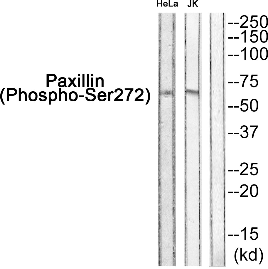 Paxillin (Phospho-Ser272) Antibody