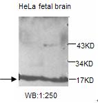 UBE2V2 Antibody