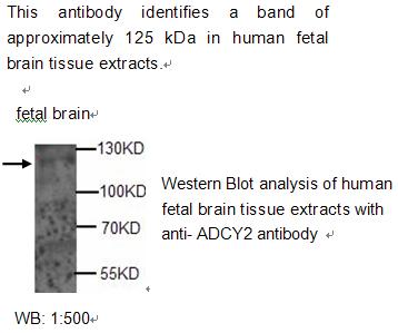 ADCY2 Antibody