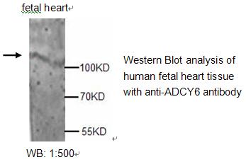 ADCY6 Antibody