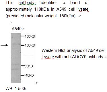 ADCY9 Antibody