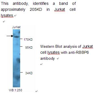 RBBP6 Antibody