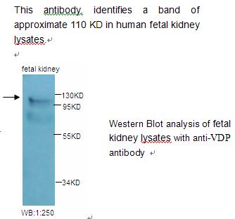 VDP Antibody