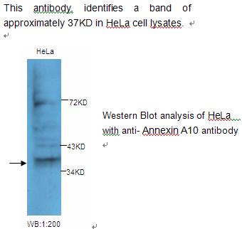 Annexin A10 Antibody