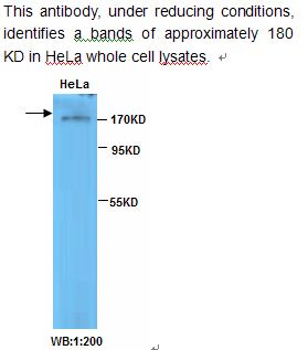 TOP2B Antibody