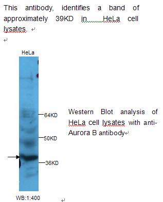 Aurora B Antibody