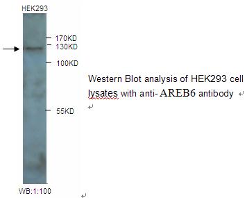 AREB6 Antibody