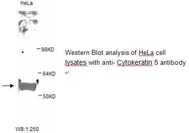 Cytokeratin 5 Antibody