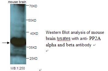 PP2A alpha and beta Antibody