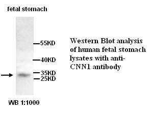 CNN1 Antibody