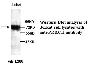 PRKCH Antibody