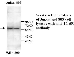 IL-6R Antibody