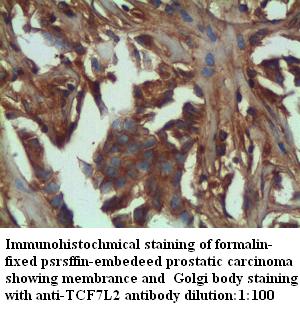 TCF7L2 Antibody