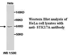 STK17A Antibody