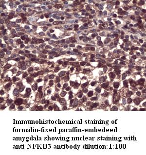 NFKB3 Antibody