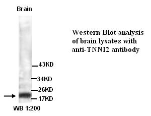  TNNI2 Antibody