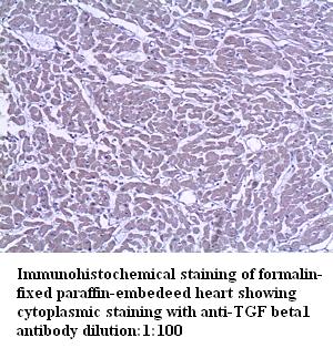 TGFβ1 Antibody