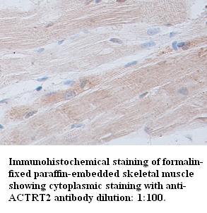 ACTRT2 Antibody