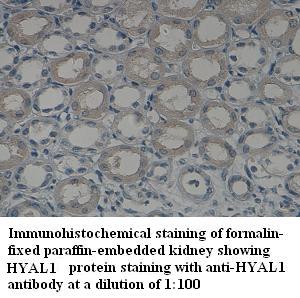 HYAL1 Antibody