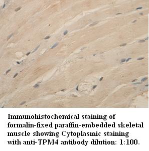 TPM4 Antibody