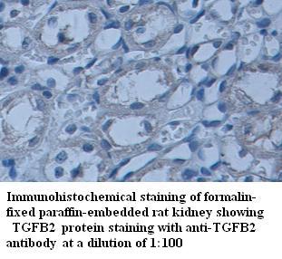 TGFB2 Antibody