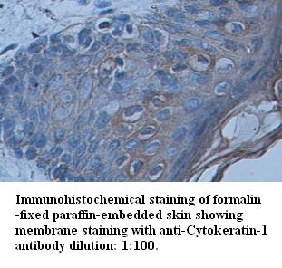 Cytokeratin-1 Antibody