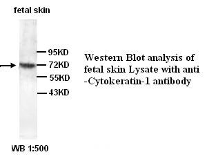 Cytokeratin-1 Antibody