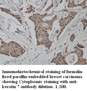 keratin 7/Cytokeratin 7 Antibody