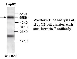 keratin 7/Cytokeratin 7 Antibody