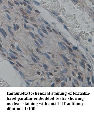 TdT Antibody