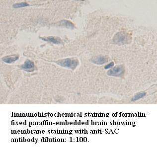 SAC Antibody