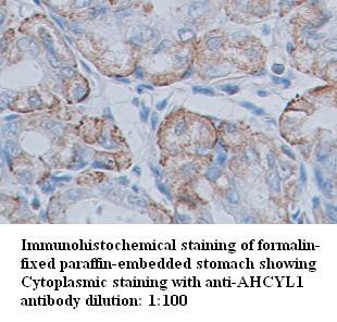 AHCYL1 Antibody