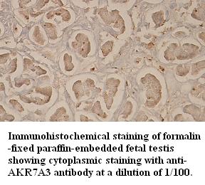 AKR7A3 Antibody