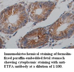 ETFA Antibody