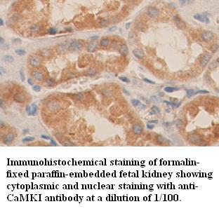 CaMKI Antibody