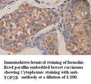 TOP2B Antibody