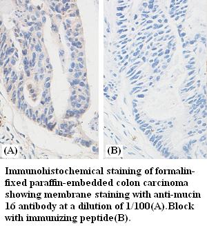 mucin 16 Antibody