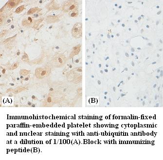 ubiquitin Antibody