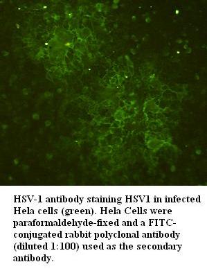 HSV-1 Antibody