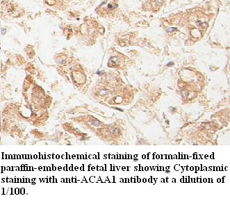 ACAA1 Antibody