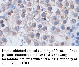  SR-B1 Antibody