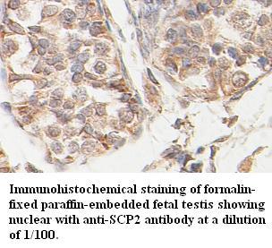 SCP2 Antibody