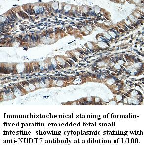 NUDT7 Antibody