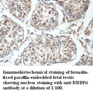 RBBP6 Antibody