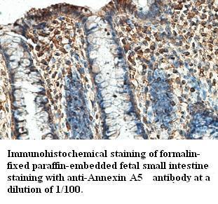 Annexin A5 Antibody