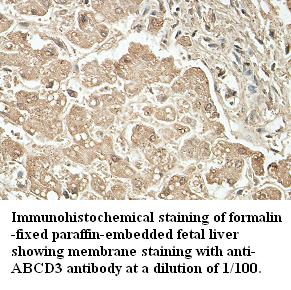 ABCD3 Antibody