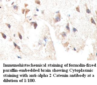  alpha 2 Catenin Antibody