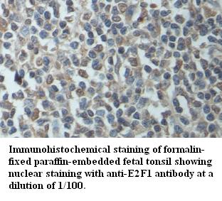 E2F1 Antibody