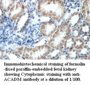 ACADM Antibody