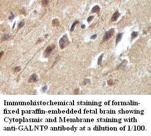 GALNT9 Antibody